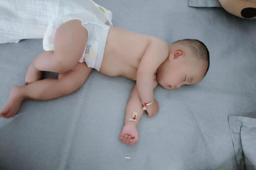 临海宝宝黄疸值多少才正常